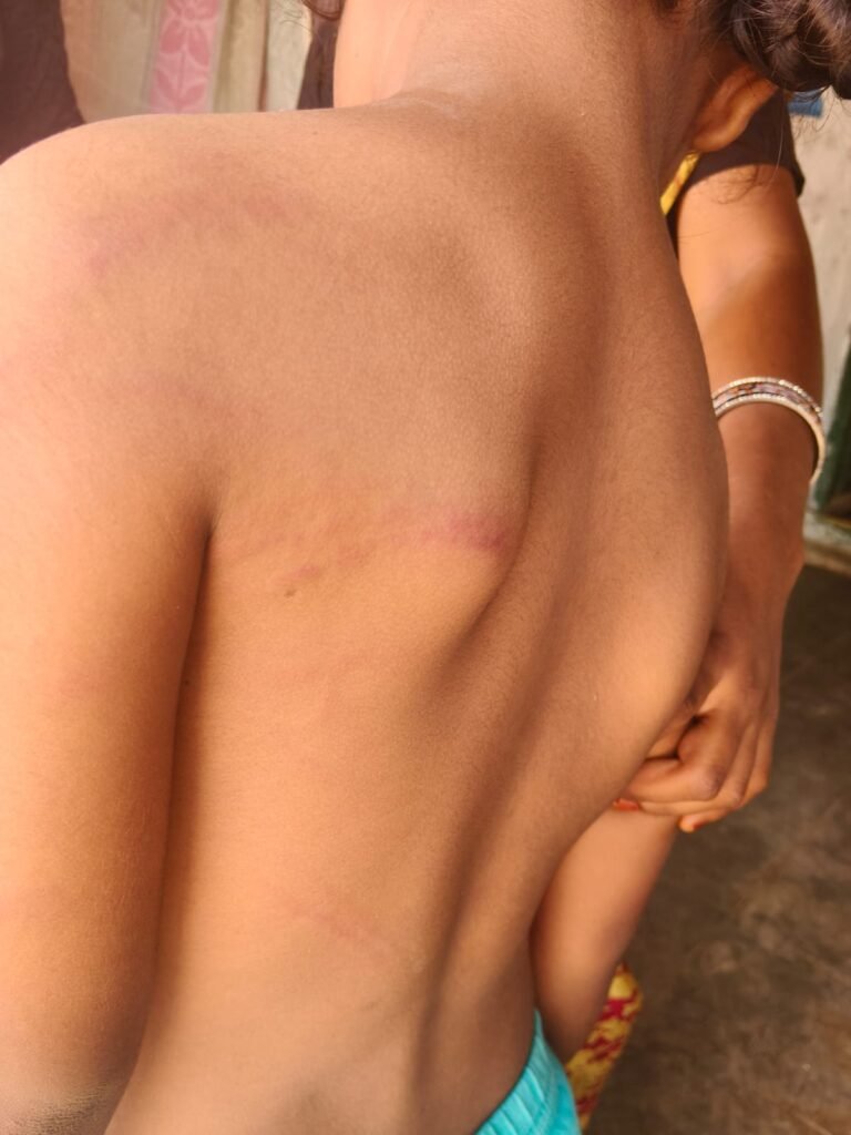 జిల్లెల్లలో ప్రైవేట్ పాఠశాలలో దారుణం<br><br>2 తరగతి చదువుతున్న సోఫియా పై ఉపాధ్యాయురాలు దాడి <br><br>విద్యార్థినిని విచక్షణారహితంగా కొట్టిన ఉపాధ్యాయురాలు<br>