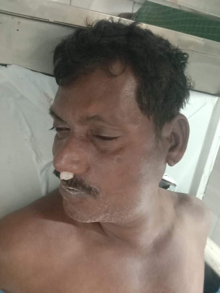 చేపలు పట్టే సమయంలో విష పురుగు కాటు -వ్యక్తి మృతి