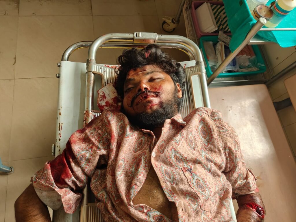 రోడ్డు ప్రమాదంలో యువకుడు మృతి. మరొకరి పరిస్థితి విషమం.